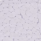 Anti-GTF2H1 Antibody