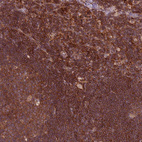 Anti-RPL21 Antibody