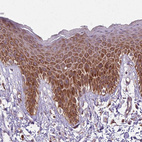 Anti-RPL21 Antibody