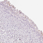 Immunohistochemical staining of human urinary bladder shows strong granular cytoplasmic positivity in urothelial cells.