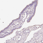 Immunohistochemical staining of human fallopian tube shows strong granular cytoplasmic positivity in glandular cells.