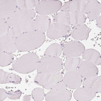 Immunohistochemical staining of human skeletal muscle shows no positivity in myocytes as expected.