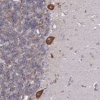 Anti-TPST1 Antibody