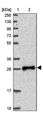 Lane 1: Marker [kDa] 250, 130, 95, 72, 55, 36, 28, 17, 10_br/_Lane 2: Human cell line RT-4