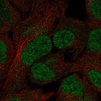 Anti-OVOL3 Antibody