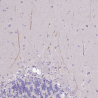 Anti-IGFL4 Antibody