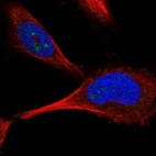 Anti-PFKFB4 Antibody