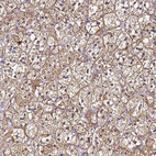 Anti-SMIM4 Antibody