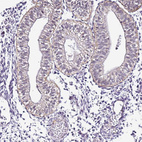 Anti-SMIM4 Antibody