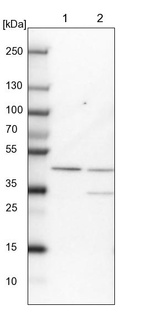 Lane 1: NIH-3T3 cell lysate (Mouse embryonic fibroblast cells)_br/_Lane 2: NBT-II cell lysate (Rat Wistar bladder tumour cells)