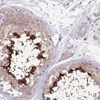 Anti-CABYR Antibody