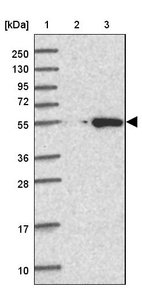 Anti-CABYR Antibody