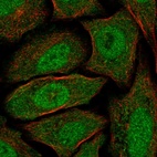 Anti-CABYR Antibody