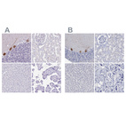 Anti-PPP1R17 Antibody