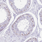 Immunohistochemical staining of human testis shows moderate to strong nuclear positivity in cells in seminiferous ducts.