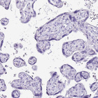 Immunohistochemical staining of human placenta shows no positivity in trophoblastic cells as expected.