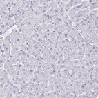 Immunohistochemical staining of human liver shows no positivity in hepatocytes as expected.