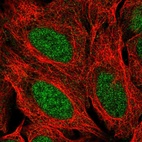 Immunofluorescent staining of human cell line U-2 OS shows localization to nucleoplasm.