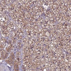 Anti-MTX3 Antibody