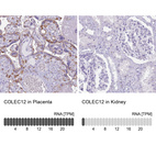 Anti-COLEC12 Antibody