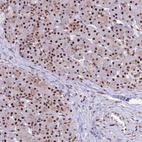 Anti-THOC2 Antibody