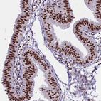 Anti-THOC2 Antibody