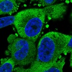 Immunofluorescent staining of human cell line PC-3 shows localization to endoplasmic reticulum.