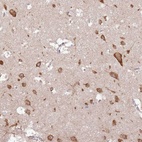 Anti-UGGT2 Antibody