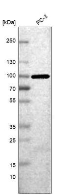 Anti-NRG2 Antibody