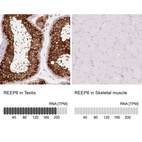 Anti-REEP6 Antibody