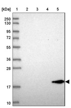 Anti-REEP6 Antibody