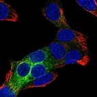 Anti-REEP6 Antibody