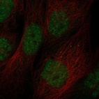 Anti-ZBTB46 Antibody