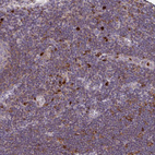 Anti-CSF3R Antibody