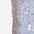 Anti-DCAF5 Antibody