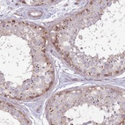 Anti-CCDC150 Antibody