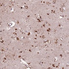 Anti-GDPGP1 Antibody