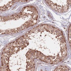 Anti-C3orf14 Antibody