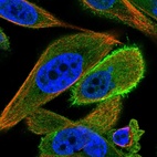 Anti-C3orf14 Antibody