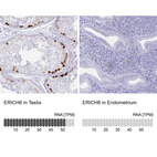 Anti-ERICH6 Antibody