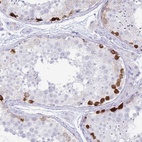 Anti-ERICH6 Antibody