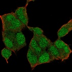 Anti-NSD1 Antibody