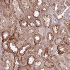 Anti-ANKRD24 Antibody