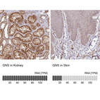 Anti-GNS Antibody