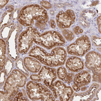 Anti-GNS Antibody