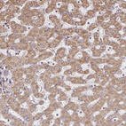 Anti-GNS Antibody