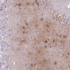 Anti-MTSS1L Antibody