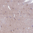 Anti-MTSS1L Antibody