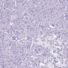 Anti-MTSS1L Antibody