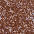 Anti-SPATA2 Antibody